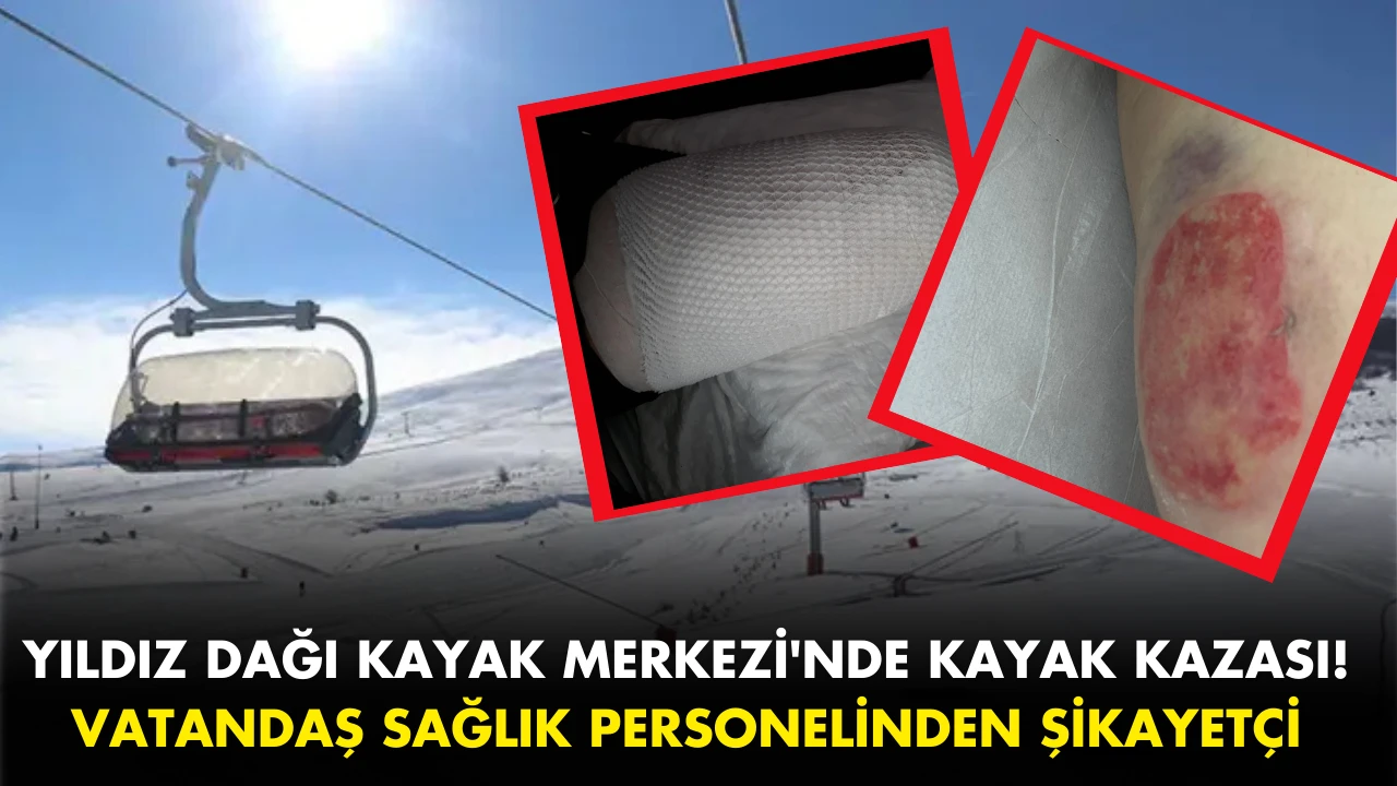 Sivas Yıldız Dağı Kayak Merkezi'nde Kayak Kazası! Vatandaş Sağlık Personelinden Şikayetçi