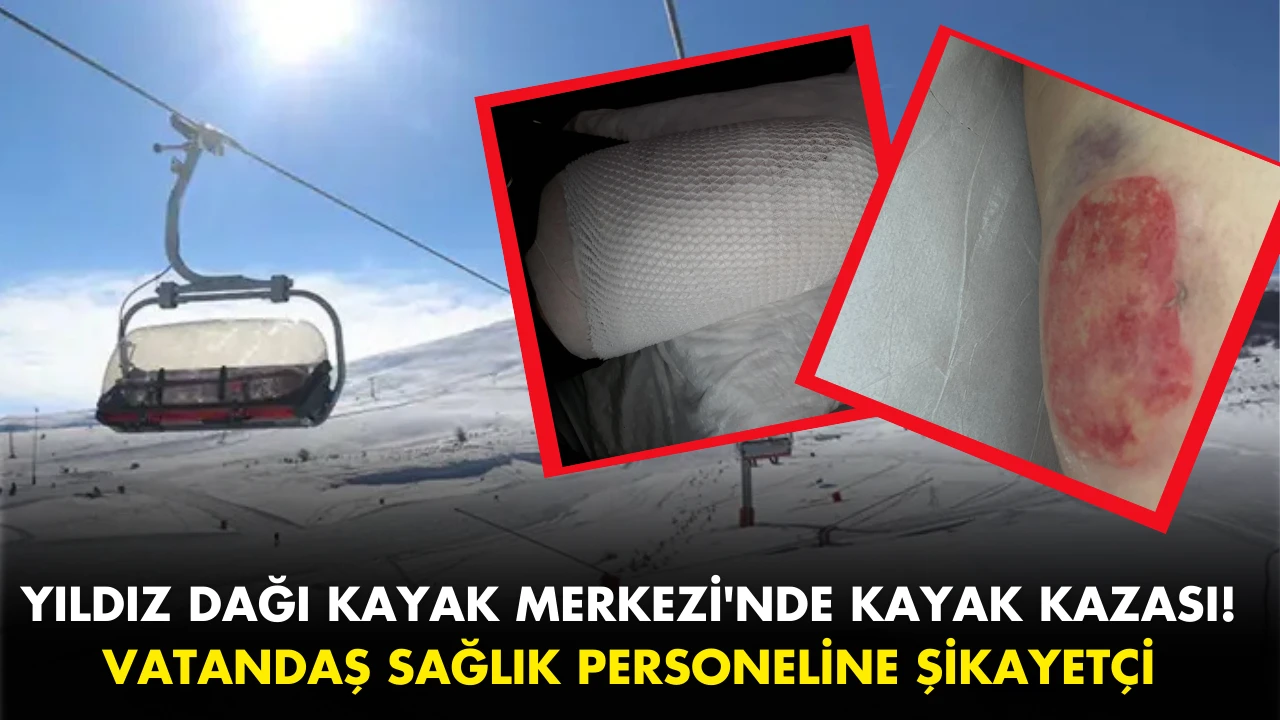 Sivas Yıldız Dağı Kayak Merkezi'nde Kayak Kazası! Vatandaş Sağlık Personeline Şikayetçi