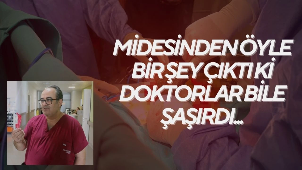 Midesinden öyle bir şey çıktı ki doktorlar bile şaşırdı...