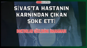 Sivas'ta Hastanın Karnından Çıkan Şoke Etti