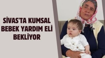 Sivas'ta Kumsal Bebek Yardım Eli Bekliyor