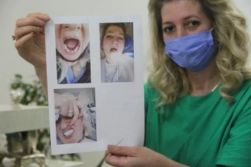 Yanlış Tedavi Nedeniyle Dişlerini Kaybetti