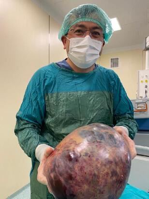 Karnından 10 kilo tümör çıkarıldı